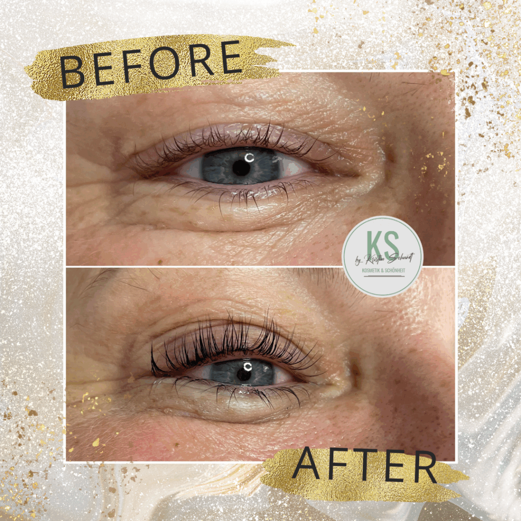 Lash Lifting, Wimpernlifting